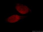 RBM15 Antibody in Immunocytochemistry (ICC/IF)