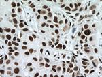 RBM15 Antibody in Immunohistochemistry (Paraffin) (IHC (P))