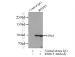 RBM15 Antibody in Immunoprecipitation (IP)