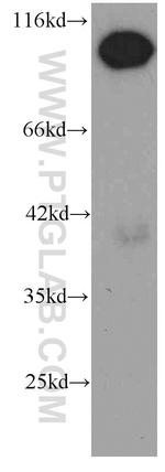 RBM15 Antibody in Western Blot (WB)