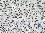 RBM15 Antibody in Immunohistochemistry (Paraffin) (IHC (P))