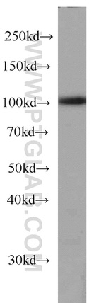 RBM15 Antibody in Western Blot (WB)