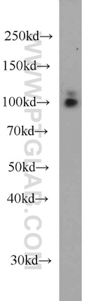 RBM15 Antibody in Western Blot (WB)