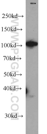 RBM15 Antibody in Western Blot (WB)