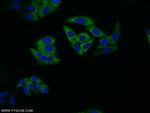 14-3-3 Antibody in Immunocytochemistry (ICC/IF)