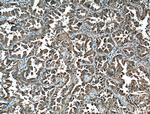 14-3-3 Antibody in Immunohistochemistry (Paraffin) (IHC (P))