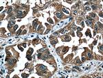 14-3-3 Antibody in Immunohistochemistry (Paraffin) (IHC (P))