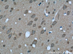 14-3-3 Antibody in Immunohistochemistry (Paraffin) (IHC (P))