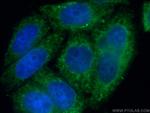 NTF2 Antibody in Immunocytochemistry (ICC/IF)