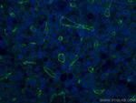 CD31 Antibody in Immunohistochemistry (Paraffin) (IHC (P))