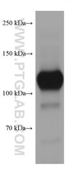 CD31 Antibody in Western Blot (WB)