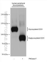 CD31 Antibody in Western Blot (WB)