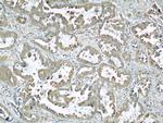 Caveolin-1 Antibody in Immunohistochemistry (Paraffin) (IHC (P))