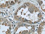 Caveolin-1 Antibody in Immunohistochemistry (Paraffin) (IHC (P))