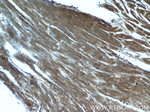 Caveolin-1 Antibody in Immunohistochemistry (Paraffin) (IHC (P))