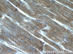 Caveolin-1 Antibody in Immunohistochemistry (Paraffin) (IHC (P))