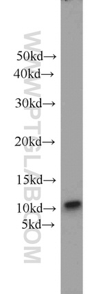 SRP9 Antibody in Western Blot (WB)