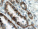 Integrin alpha-3 Antibody in Immunohistochemistry (Paraffin) (IHC (P))