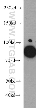 EPLIN Antibody in Western Blot (WB)