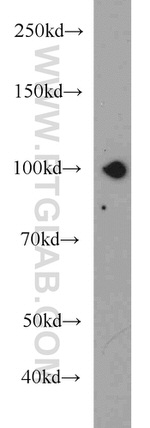 EPLIN Antibody in Western Blot (WB)