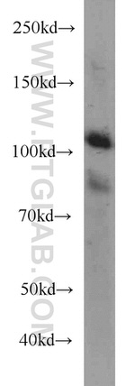 EPLIN Antibody in Western Blot (WB)