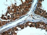 CPT1C Antibody in Immunohistochemistry (Paraffin) (IHC (P))