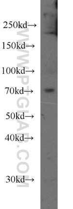 CPT1C Antibody in Western Blot (WB)