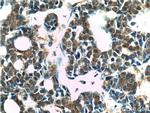 PMS2 Antibody in Immunohistochemistry (Paraffin) (IHC (P))