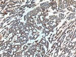 PMS2 Antibody in Immunohistochemistry (Paraffin) (IHC (P))