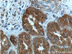 TELO2 Antibody in Immunohistochemistry (Paraffin) (IHC (P))