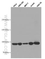 TELO2 Antibody in Western Blot (WB)