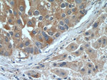 TELO2 Antibody in Immunohistochemistry (Paraffin) (IHC (P))