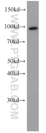 TELO2 Antibody in Western Blot (WB)