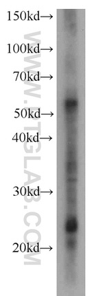 Phospho-TDP43 (Ser403, Ser404) Antibody in Western Blot (WB)