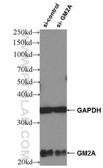 GM2A Antibody in Western Blot (WB)