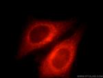 IFITM2/3 Antibody in Immunocytochemistry (ICC/IF)