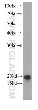 UBE2C Antibody in Western Blot (WB)