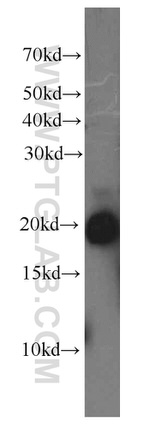 UBE2C Antibody in Western Blot (WB)