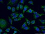 NCALD Antibody in Immunocytochemistry (ICC/IF)