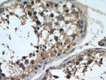 NCALD Antibody in Immunohistochemistry (Paraffin) (IHC (P))