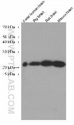 NCALD Antibody in Western Blot (WB)