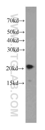 NCALD Antibody in Western Blot (WB)