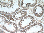 NCALD Antibody in Immunohistochemistry (Paraffin) (IHC (P))