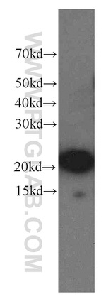 NCALD Antibody in Western Blot (WB)