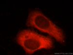 Factor XII Antibody in Immunocytochemistry (ICC/IF)