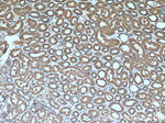 Factor XII Antibody in Immunohistochemistry (Paraffin) (IHC (P))