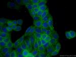 Caspase 8 Antibody in Immunocytochemistry (ICC/IF)