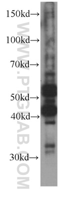 Caspase 8 Antibody in Western Blot (WB)