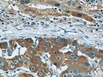 Fetuin-A Antibody in Immunohistochemistry (Paraffin) (IHC (P))