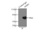 Fetuin-A Antibody in Immunoprecipitation (IP)